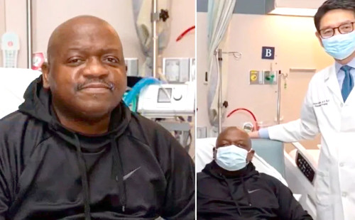 শরীরে শূকরের কিডনি প্রতিস্থাপন করা সেই ব্যক্তি মারা গেছেন 