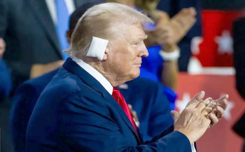 ডান কানে বড় ব্যান্ডেজ নিয়ে দলের জাতীয় সম্মেলনে ট্রাম্প 