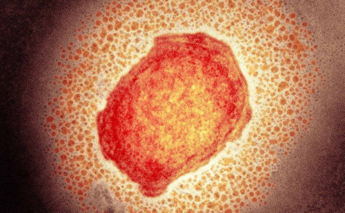 মাংকিপক্স শনাক্ত করতে সক্ষম যবিপ্রবির জিনোম সেন্টার 